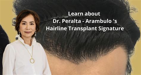 hair transplant cebu|World Class Hair Transplant .